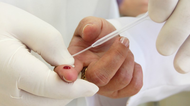 O teste r&aacute;pido de HIV e s&iacute;filis &eacute; seguro e sigiloso e leva em m&eacute;dia vinte minutos para determinar o resultado, a partir de uma gota de sangue